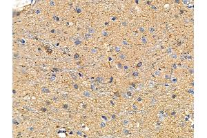 ABIN6258262 and ABIN6273481 at 1/100 staining Rat brain tissue by IHC-P.