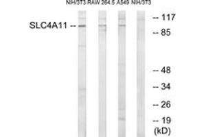 Western blot analysis of extracts from NIH-3T3/RAW264. (SLC4A11 anticorps  (AA 291-340))