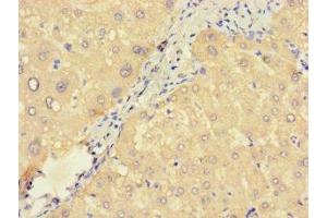 Immunohistochemistry of paraffin-embedded human liver tissue using ABIN7166376 at dilution of 1:100 (ZNF738 anticorps  (AA 1-137))