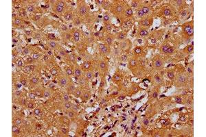 IHC image of ABIN7168014 diluted at 1:200 and staining in paraffin-embedded human liver tissue performed on a Leica BondTM system.