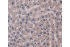 IHC-P analysis of Rat Tissue, with DAB staining. (MYH8 anticorps  (AA 40-240))