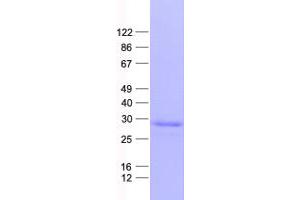Validation with Western Blot