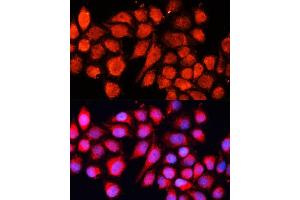Immunofluorescence analysis of HeLa cells using MRPS28 Polyclonal Antibody (ABIN6133074, ABIN6144041, ABIN6144042 and ABIN6220731) at dilution of 1:100 (40x lens). (MRPS28 anticorps  (AA 1-187))