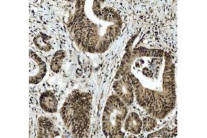 IHC analysis of SFPQ using anti-SFPQ antibody (ABIN7603089). (SFPQ anticorps  (Middle Region))