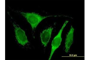 Immunofluorescence of purified MaxPab antibody to C1QBP on HeLa cell.