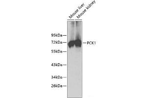 Western blot analysis of extracts of various cell lines using PCK1 Polyclonal Antibody. (PCK1 anticorps)