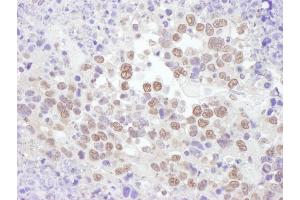 anti-Ring Finger Protein 20 (RNF20) (AA 125-175) antibody