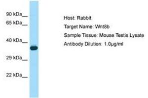 Image no. 1 for anti-Wingless-Type MMTV Integration Site Family, Member 8B (WNT8B) (AA 251-300) antibody (ABIN6749826) (WNT8B anticorps  (AA 251-300))