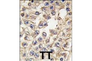 Formalin-fixed and paraffin-embedded human testis tissue reacted with EPHA10 antibody (Center), which was peroxidase-conjugated to the secondary antibody, followed by DAB staining.