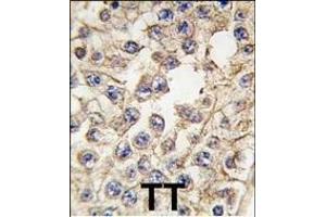 Formalin-fixed and paraffin-embedded human testis tissue reacted with EPHA10 antibody (Center), which was peroxidase-conjugated to the secondary antibody, followed by DAB staining. (EPH Receptor A10 anticorps  (AA 440-469))
