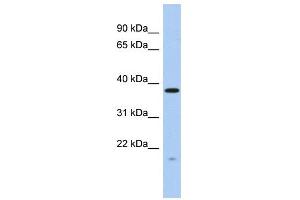 WB Suggested Anti-RWDD2A Antibody Titration: 0. (RWDD2A anticorps  (N-Term))