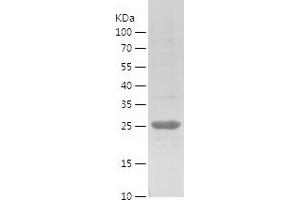 Western Blotting (WB) image for Excision Repair Cross Complementing Polypeptide-1 (ERCC1) (AA 1-200) protein (His tag) (ABIN7122858)