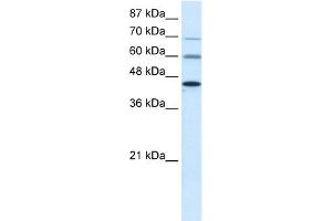 WB Suggested Anti-PRMT3 Antibody Titration:  0. (PRMT3 anticorps  (Middle Region))