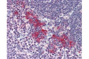 Anti-DNASE2 / DNase II antibody IHC of human thymus. (DNASE2 anticorps  (AA 347-360))