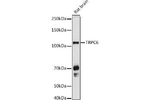 Western blot analysis of extracts of Rat brain, using TRPC6 antibody (ABIN6133946, ABIN6149580, ABIN6149581 and ABIN6224178) at 1:1000 dilution.