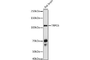 Western blot analysis of extracts of Rat brain, using TRPC6 antibody (ABIN6133946, ABIN6149580, ABIN6149581 and ABIN6224178) at 1:1000 dilution. (TRPC6 anticorps  (AA 500-600))