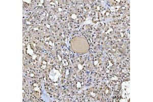 IHC analysis of SAP130 using anti-SAP130 antibody (ABIN7601247). (SAP130 anticorps  (AA 309-913))