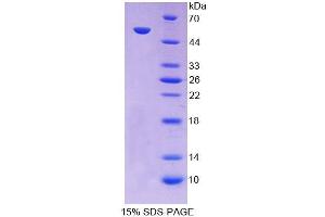 SDS-PAGE analysis of Human PC Protein. (PC Protéine)