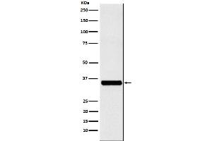 Western blot analysis of EXOSC7 expression in Jurkat cell lysate.