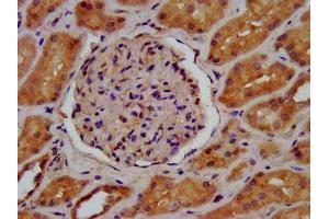 IHC image of ABIN7157971 diluted at 1:600 and staining in paraffin-embedded human kidney tissue performed on a Leica BondTM system.
