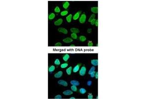 ICC/IF Image Immunofluorescence analysis of paraformaldehyde-fixed HeLa, using VCP(p97), antibody at 1:200 dilution. (VCP anticorps  (N-Term))