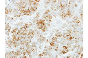 IHC-P Image Immunohistochemical analysis of paraffin-embedded MCF7 xenograft, using KYNU, antibody at 1:500 dilution.