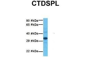 Host:  Rabbit  Target Name:  CTDSPL  Sample Tissue:  Human Fetal Liver  Antibody Dilution:  1. (CTDSPL anticorps  (N-Term))