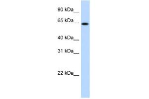 WB Suggested Anti-RNF6 Antibody Titration:  1. (RNF6 anticorps  (N-Term))