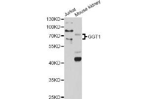 Western blot analysis of extracts of various cell lines, using GGT1 antibody (ABIN1872809) at 1:1000 dilution. (GGT1 anticorps)