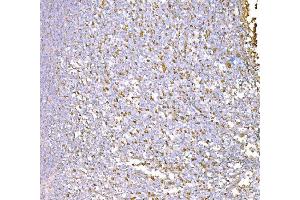 IHC analysis of SND1 using anti-SND1 antibody (ABIN7600525). (SND1 anticorps  (AA 20-204))