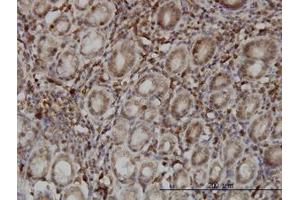 Image no. 1 for anti-SUMO1/sentrin Specific Protease 6 (SENP6) (AA 1-111) antibody (ABIN599203) (SENP6 anticorps  (AA 1-111))