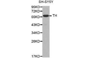 Western Blotting (WB) image for anti-Tyrosine Hydroxylase (TH) antibody (ABIN6213590) (Tyrosine Hydroxylase anticorps)