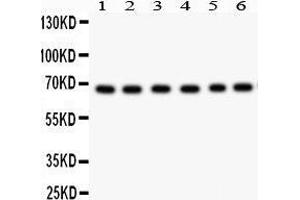 Anti- PKC iota Picoband antibody, Western blotting All lanes: Anti PKC iota  at 0. (PKC iota anticorps  (AA 21-214))