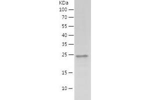 Western Blotting (WB) image for Mediator Complex Subunit 19 (MED19) (AA 1-194) protein (His tag) (ABIN7123870)
