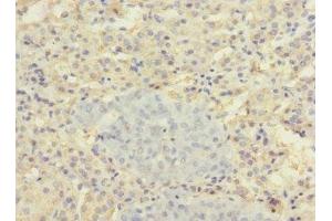 Immunohistochemistry of paraffin-embedded human adrenal gland tissue using ABIN7170165 at dilution of 1:100 (SLC22A8 anticorps  (AA 473-542))