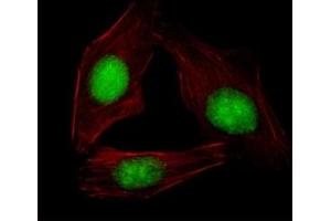 Fluorescent image of U251 cells stained with SREBP2 antibody.