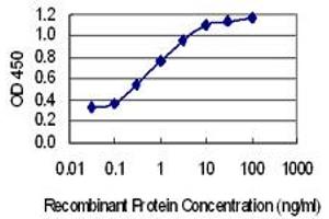 anti-F-Box Protein 41 (FBXO41) (AA 400-498) antibody