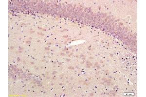 Formalin-fixed and paraffin embedded rat hippocampus labeled with Rabbit Anti-alpha-Synuclein (NT) Polyclonal Antibody, Unconjugated  1:300 followed by conjugation to the secondary antibody and DAB staining (SNCA anticorps  (AA 51-90))