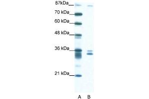 WB Suggested Anti-PKNOX2 Antibody Titration: 1.