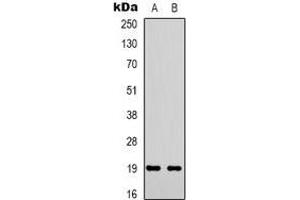 Western blot analysis of STMN1 (pS38) expression in Hela (A), Jurkat (B) whole cell lysates. (Stathmin 1 anticorps  (N-Term, pSer38))