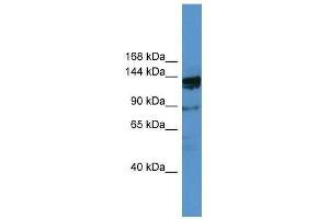 OGDHL antibody used at 0. (OGDHL anticorps  (N-Term))