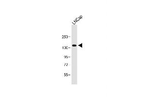 Anti-POTEE Antibody (Center) at 1:1000 dilution + LNCap whole cell lysate Lysates/proteins at 20 μg per lane.
