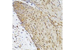 Immunohistochemistry of paraffin-embedded human esophagus using TOLLIP antibody. (TOLLIP anticorps)