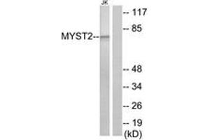 Western Blotting (WB) image for anti-MYST Histone Acetyltransferase 2 (MYST2) (AA 131-180) antibody (ABIN2889358) (MYST2 anticorps  (AA 131-180))