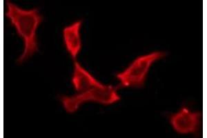 ABIN6276265 staining MCF7 by IF/ICC.