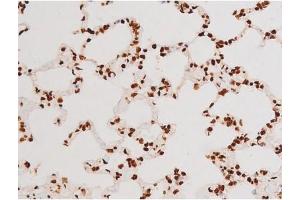 ABIN6267604 at 1/200 staining Rat lung tissue sections by IHC-P.