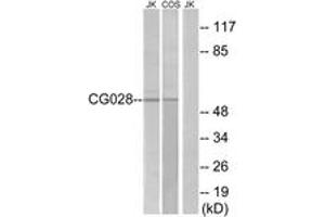 Western blot analysis of extracts from Jurkat/COS cells, using CG028 Antibody. (CCZ1B anticorps  (AA 411-460))