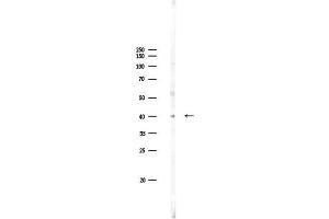 anti-Family with Sequence Similarity 203, Member B (FAM203B) (Internal Region) antibody