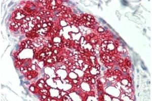 Human Skin, Sebaceous Gland: Formalin-Fixed, Paraffin-Embedded (FFPE)