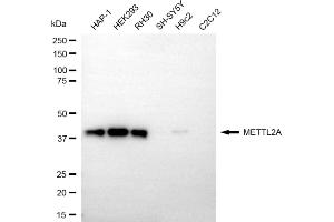 Western blotting analysis using METTL2A antibody (ABIN7799399).